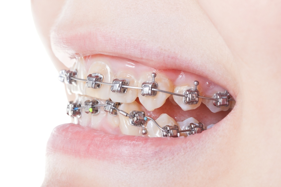 Dentofacial-image
