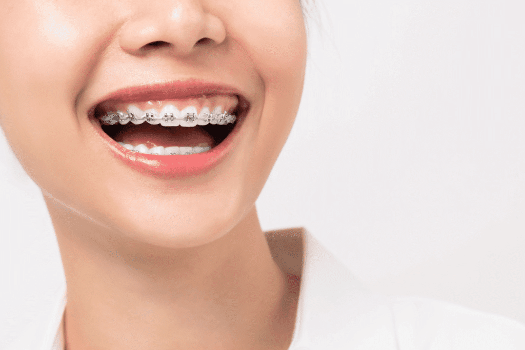 patient smiling with braces