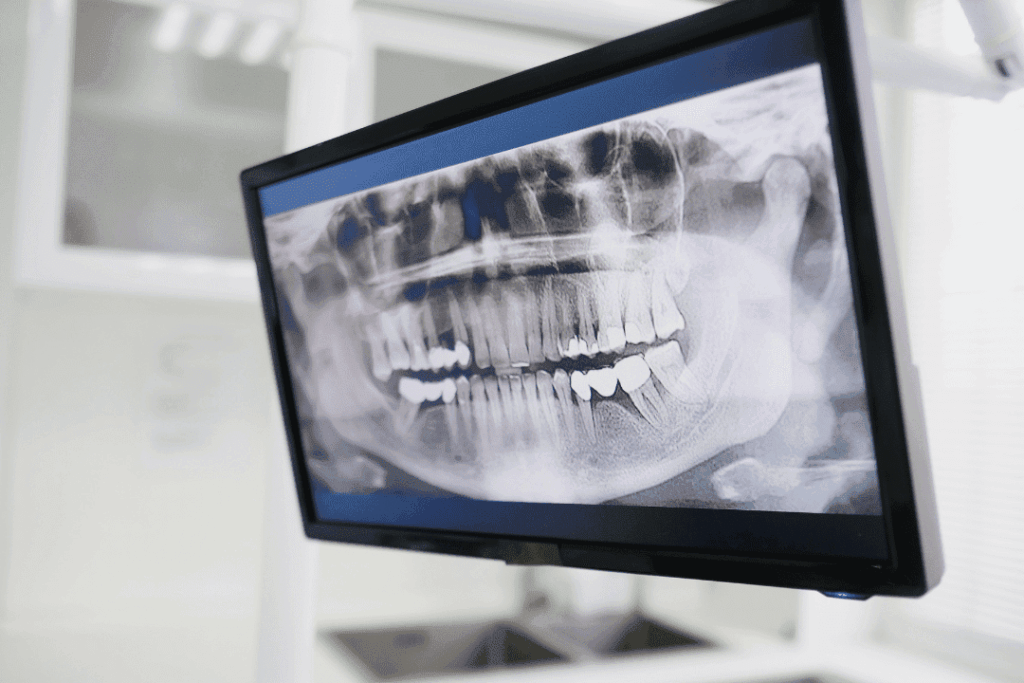 3D imaging for orthodontics