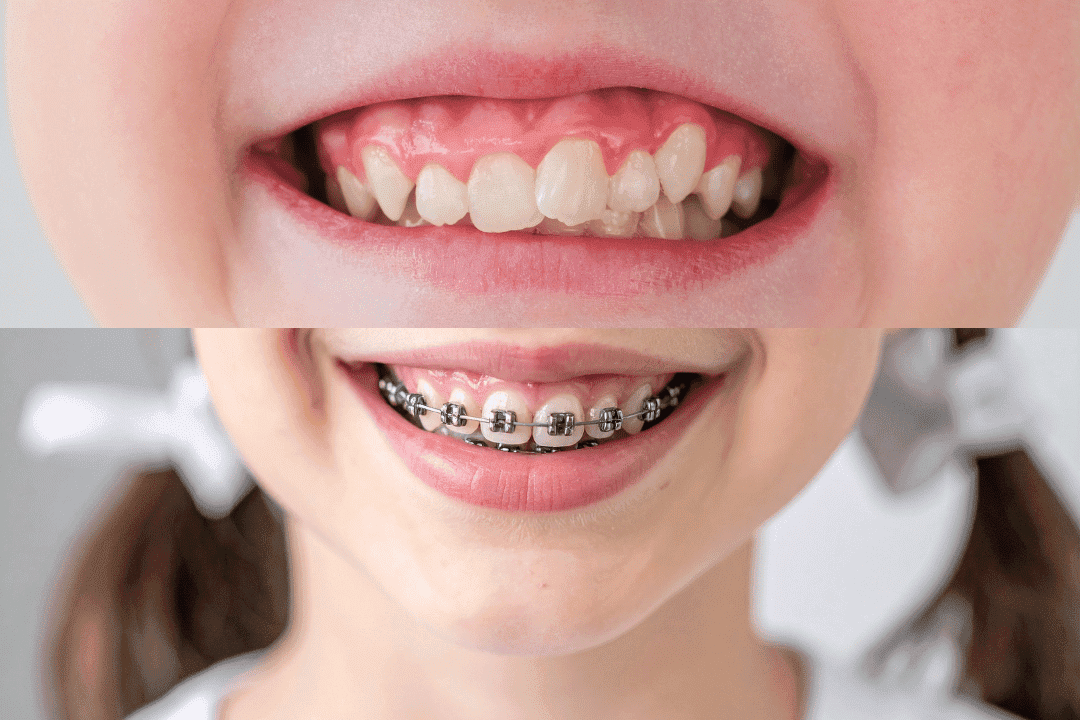 child orthodontic evaluation