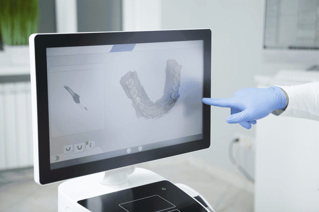 digital scanning orthodontic process
