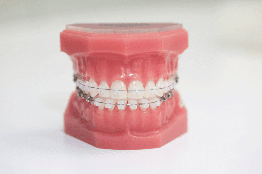 how braces work during orthodontic treatment
